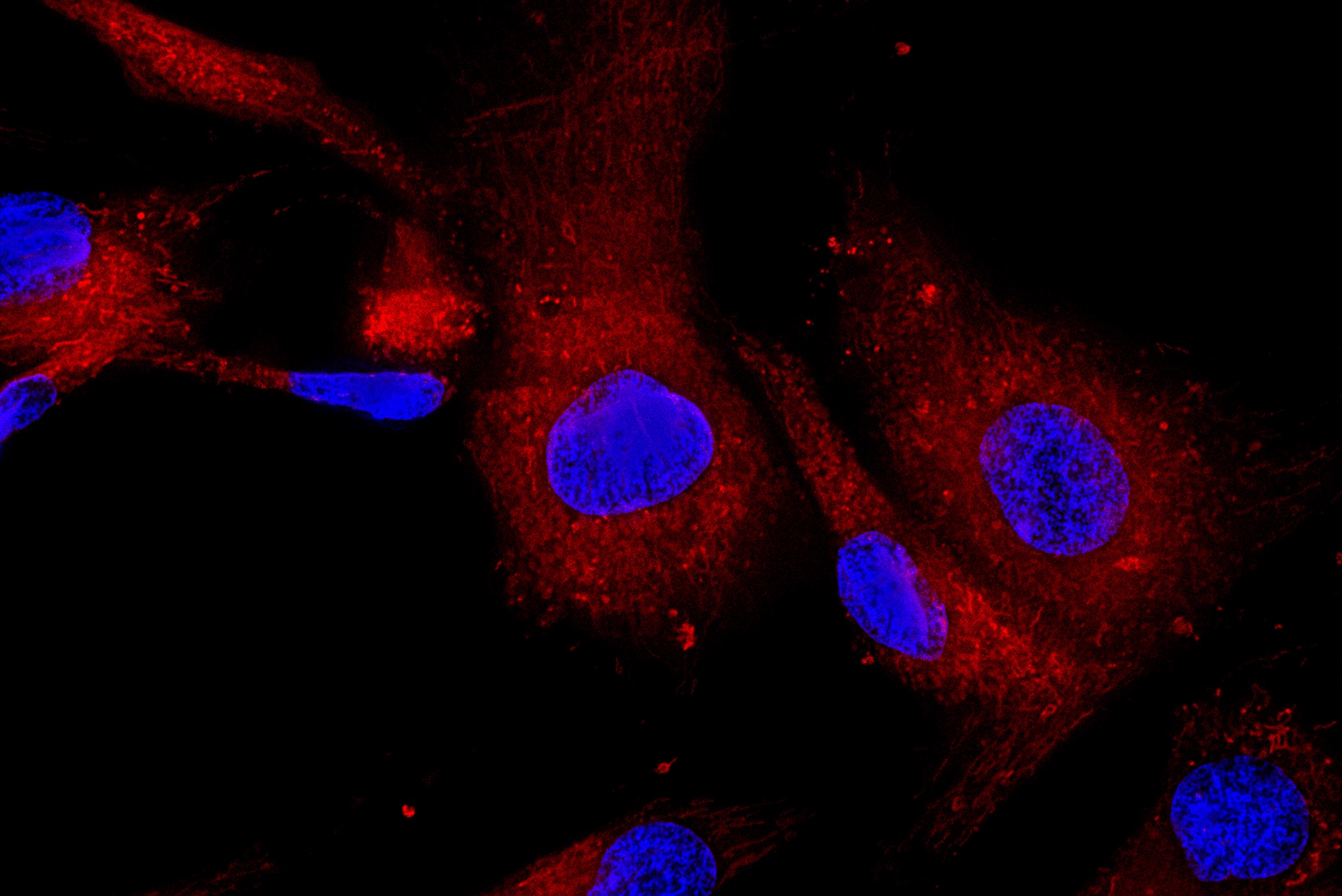 Harvest of live stem cells is impacted by bone marrow aspiration technique.