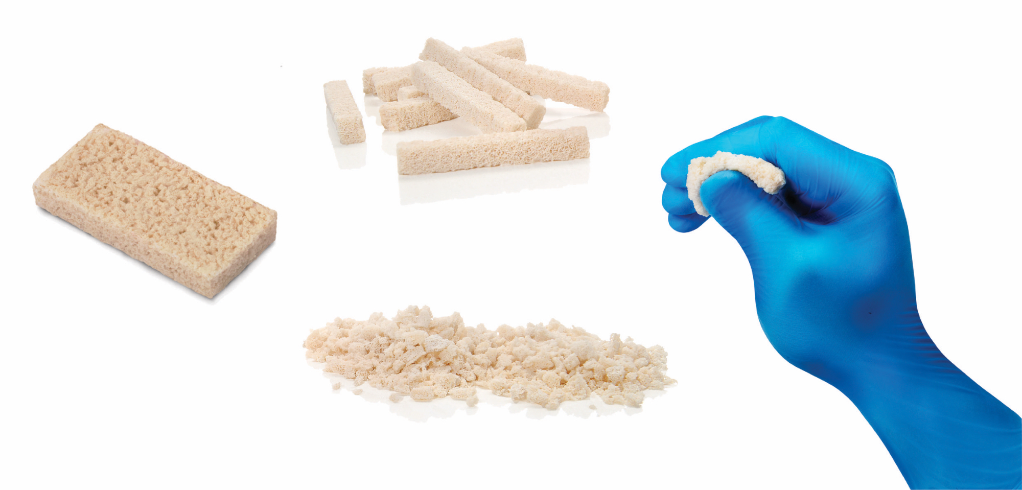 Various types of bone grafts including granules, blocks, putty, and strips/sheets.