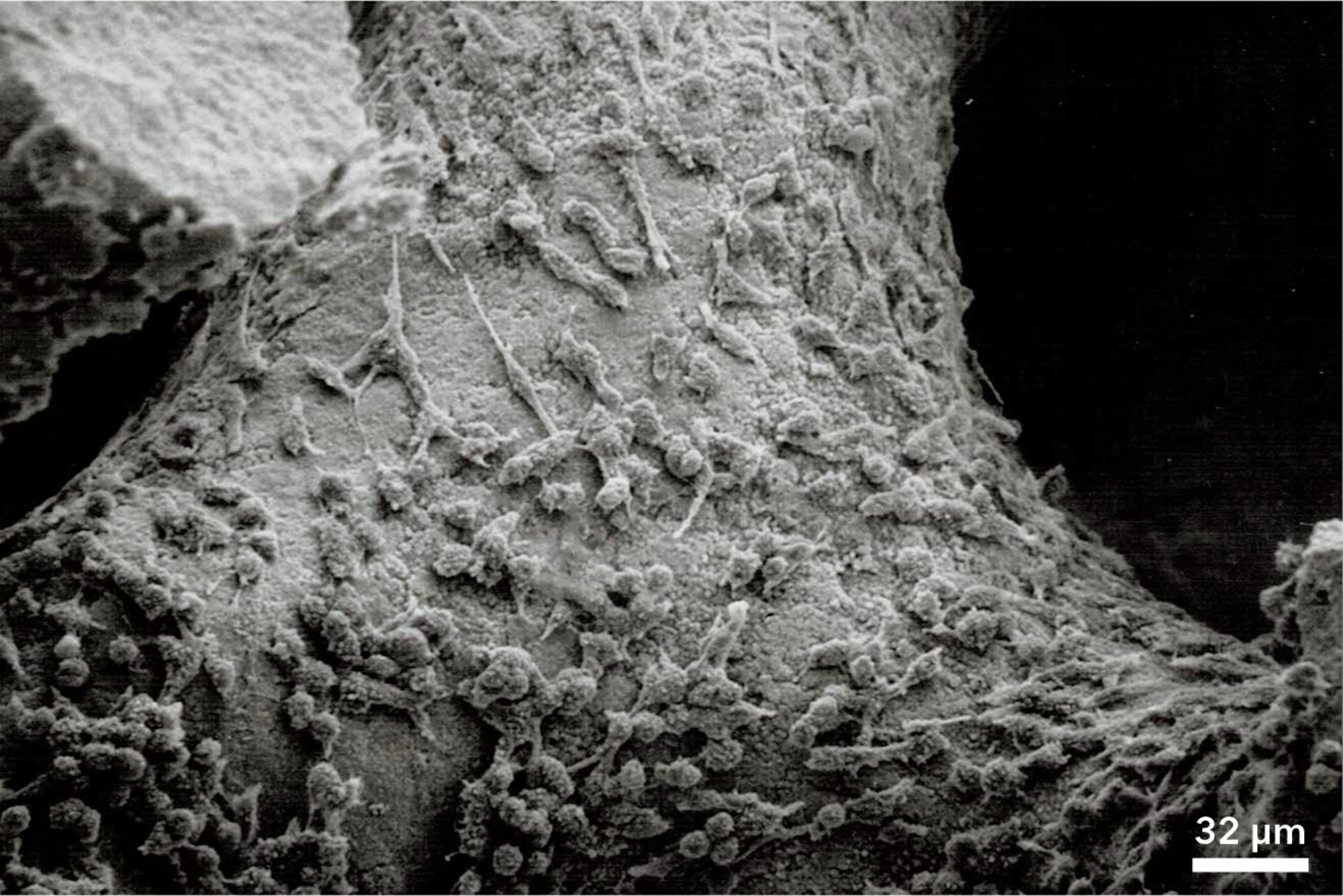 Cells growing on surface of biologically active bone graft material.