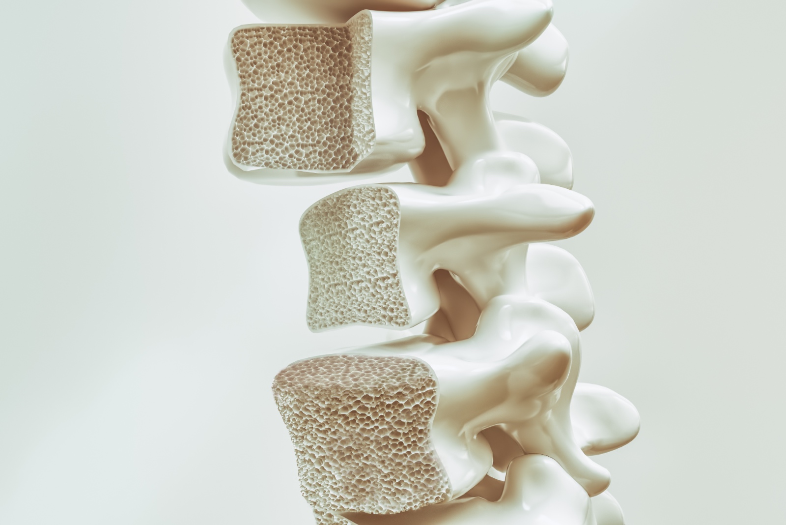 Cancellous and cortical types of human bone.