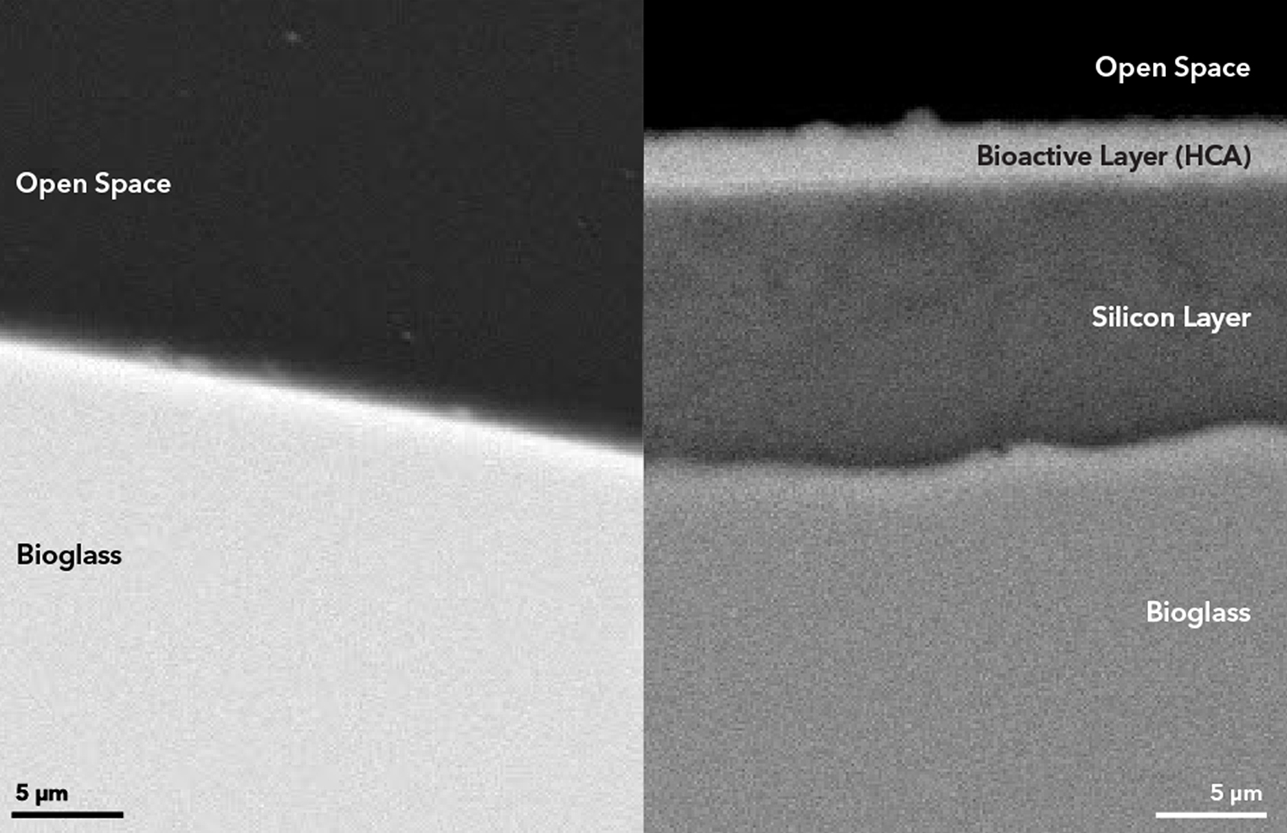 Advanced synthetics and bioglass bone grafts can form a bioactive layer of HCA