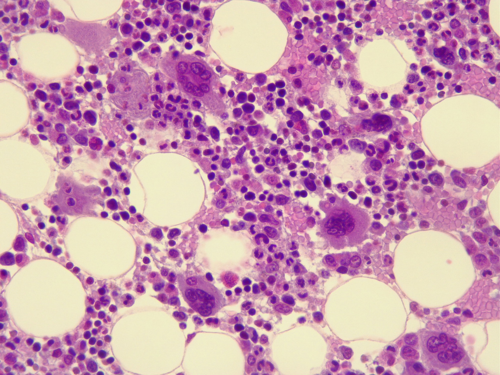 Human bone marrow under the microscope, x400 magnification