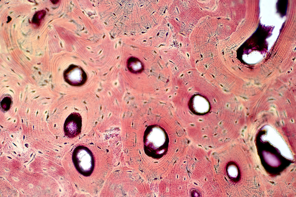 Microscopic image of human cortical bone.