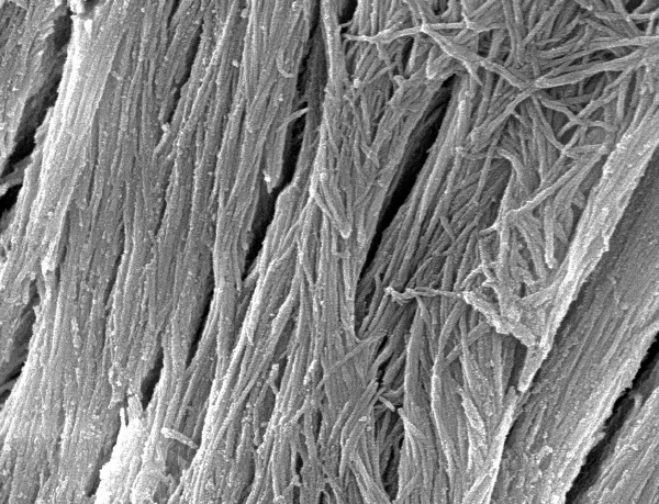 Mineralized collagen fibers in bone (electron micrograph, 10,000X)