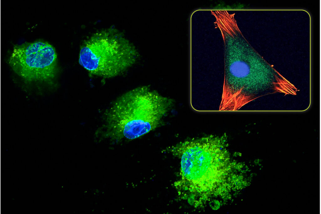 Iridescent staining of mesenchymal stem cells 